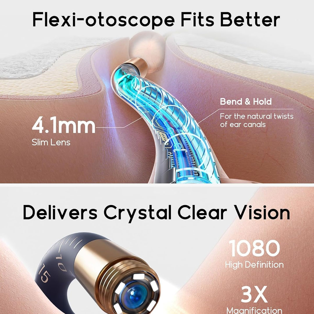 گوش پاک کن هوشمند شیائومی مدل Bebird I35R Earsight Plus