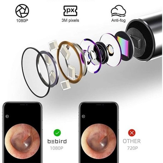 گوش پاک کن برقی ببیرد مدل Visual Ear cleaner (R1+)